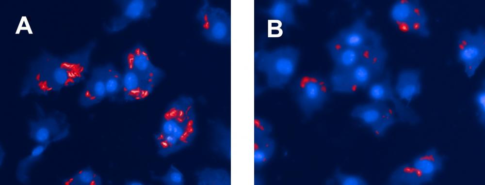 L'activité antibactérienne intrinsèque des nanoparticules fabriquées à partir de β-cyclodextrines potentialise leur effet dans la lutte contre la tuberculose